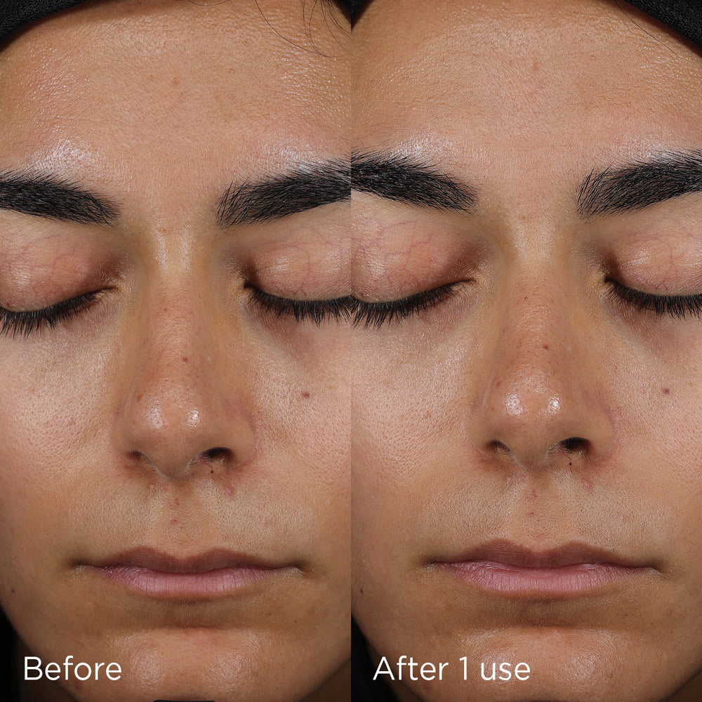Before and after of a woman’s face showing the effects of using IMAGE Skincare Daily Prevention Sheer Matte Moisturiser SPF 30.