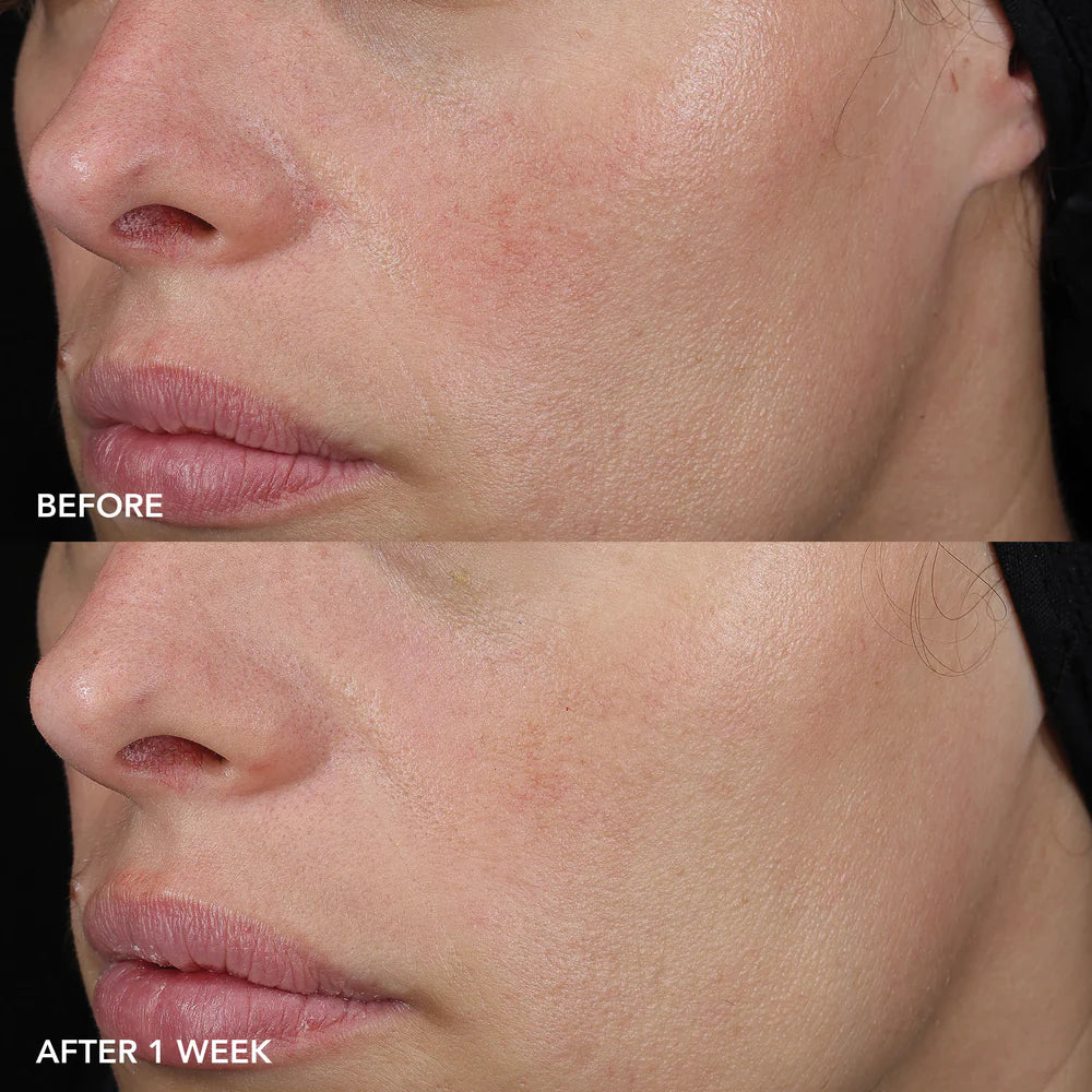 IMAGE MD Barrier Repair Recovery Balm
